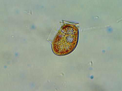 Dinophysis_2_400x