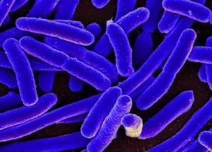 Colorized scanning electron micrograph of Escherichia coli, grown in culture and adhered to a cover slip. (Creative Commons photo by National Institute of Allergy and Infectious Diseases)
